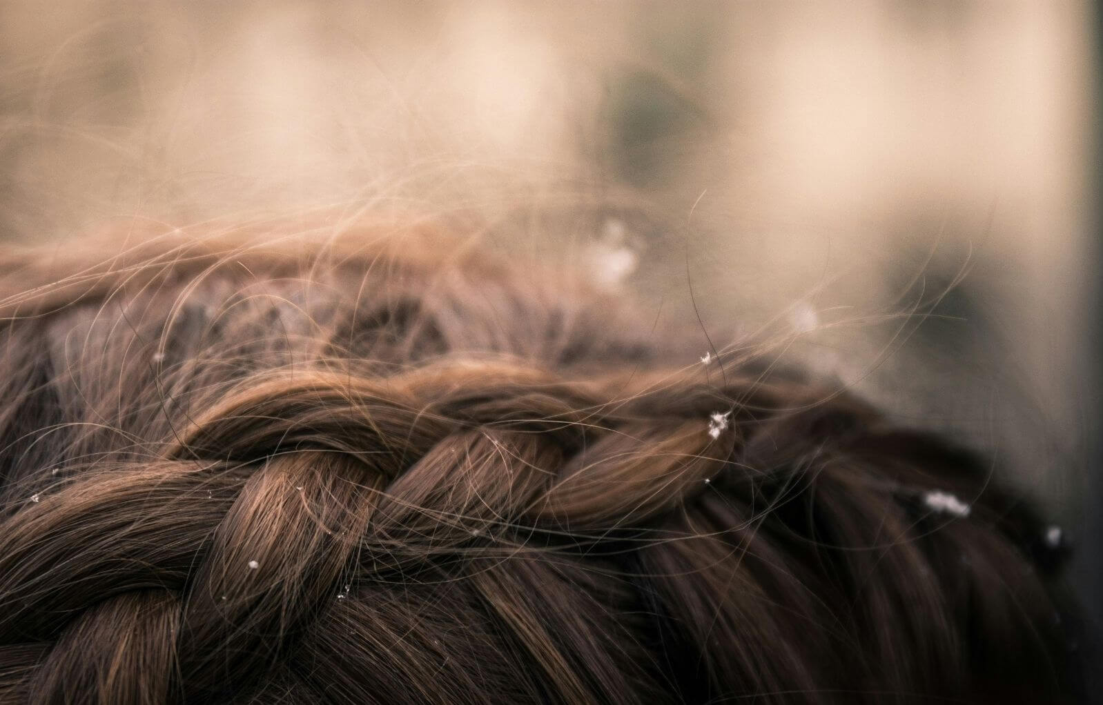 Dandruff vs. Dry Scalp: What’s the Difference—and How Do You Treat Each One Effectively? - TOUCHBeauty