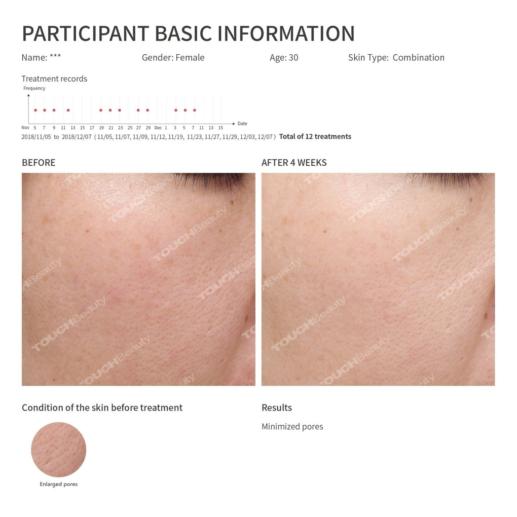 Hot/Cool Skin Device - TOUCHBeauty